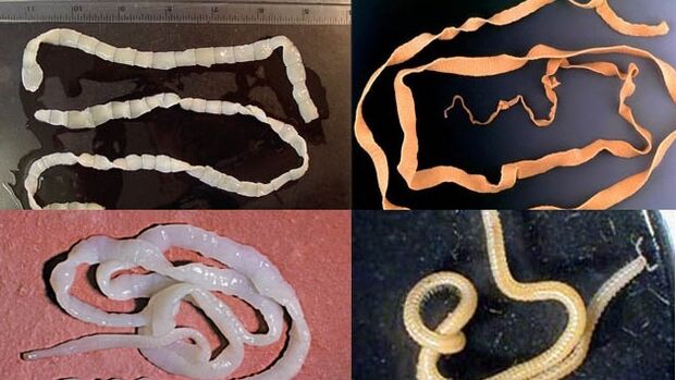 Types de parasites