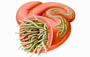 Comment nettoyer les intestins des parasites
