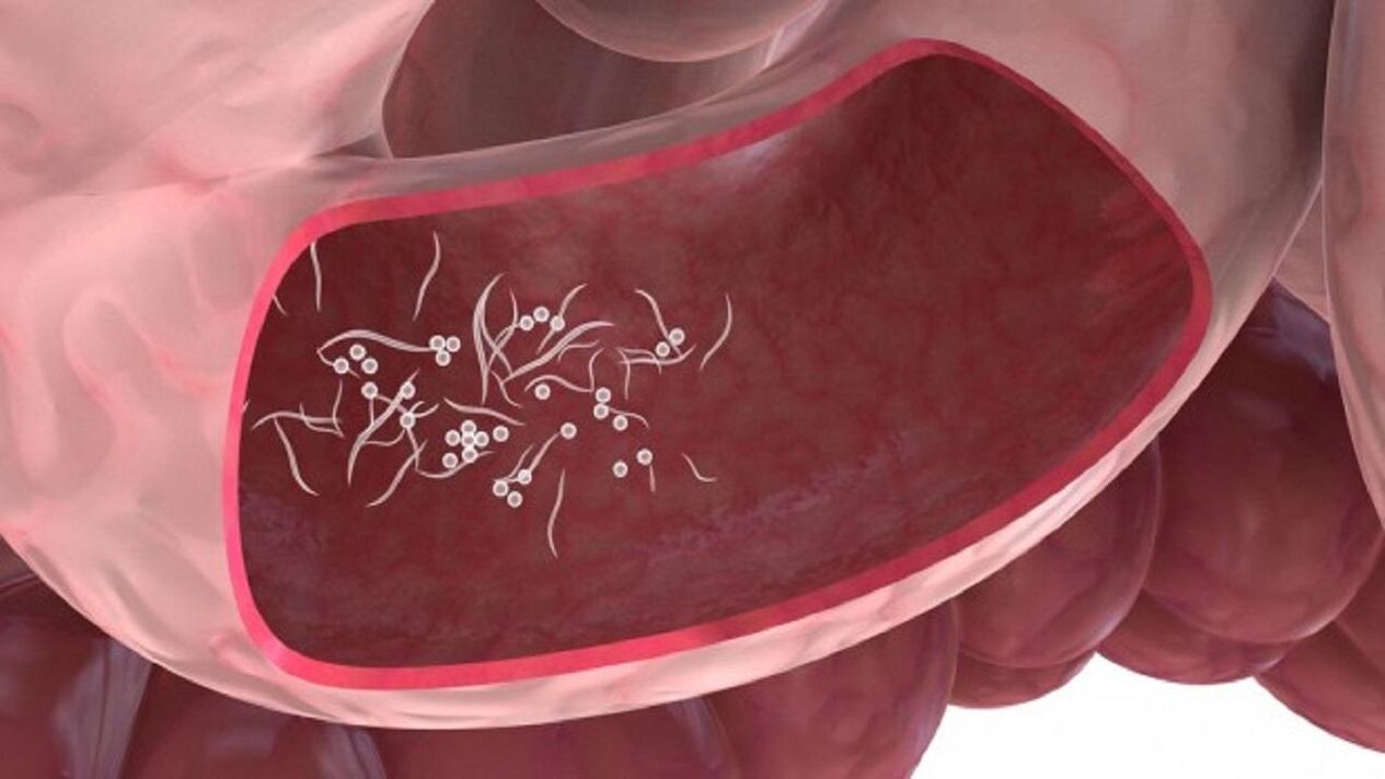 Giardia parasites dans le foie.
