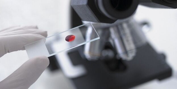 test sanguin pour diagnostiquer les parasites dans le corps