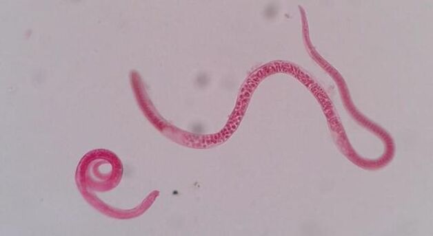 À quoi ressemble la trichinelle