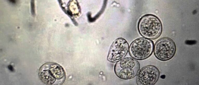 cellules protozoaires parasites